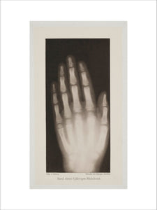 Hand of an 8 year-old girl, 1896.